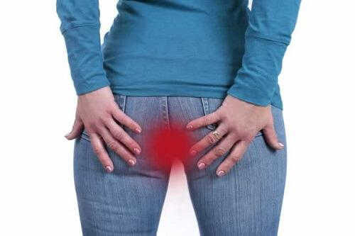 7 nguyên nhân căng tức hậu môn và cách chữa tại nhà