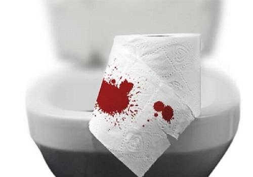 Đại tiện ra máu ở nữ giới: Nguyên nhân, triệu chứng, cách điều trị