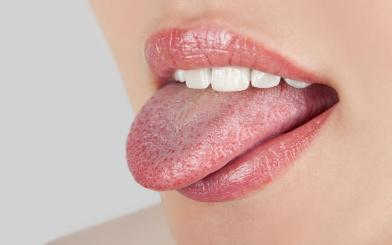 Đầu lưỡi nổi hột đỏ đau rát: Triệu chứng bệnh không thể coi thường