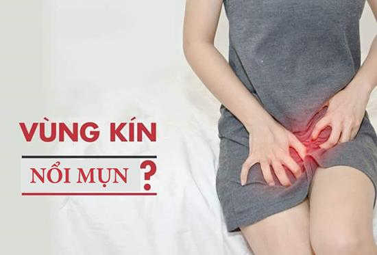 Nổi Nốt Trắng Ở Vùng Kín