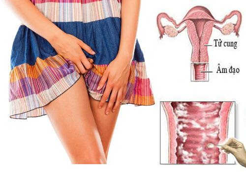 Ngứa Vùng Kín Ngày Rụng Trứng