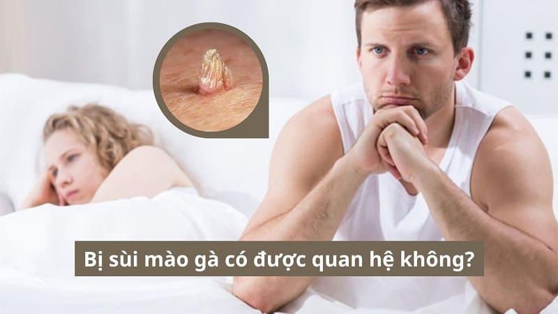 Bị sùi mào gà có được quan hệ không? - Chuyên gia giải đáp