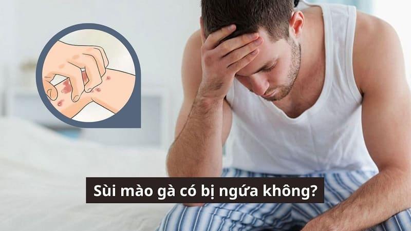 Sùi mào gà có bị ngứa không? 5 dấu hiệu cơ bản cần lưu ý