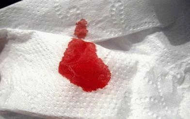 10 nguyên nhân chảy máu sau quan hệ một tuần ở nữ giới!