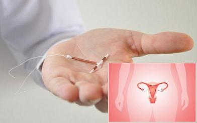 Dấu hiệu lệch vòng tránh thai là gì? Địa chỉ đặt vòng tránh thai uy tín tại Hà Nội