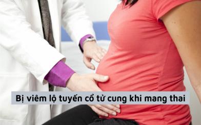 Bị viêm lộ tuyến cổ tử cung khi mang thai và những điều chị em nên biết