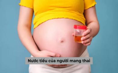 Nước tiểu của người mang thai và những thông tin quan trọng bạn cần nắm
