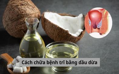 Cách chữa bệnh trĩ bằng dầu dừa đơn giản không ngờ, bạn đã thử chưa?
