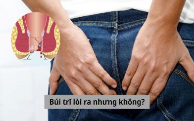 Búi trĩ lòi ra nhưng không đau thì có cần thiết phải chữa trị hay không?