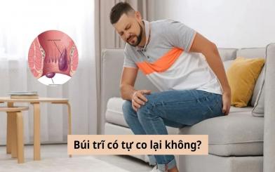 Chuyên gia giải đáp: Bị sa búi trĩ có tự co lại không?