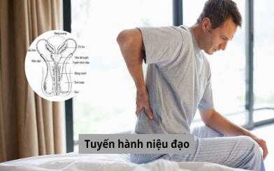 Cập nhật từ A - Z về tuyến hành niệu đạo ở phái mạnh