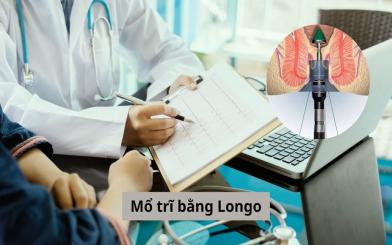 Những điều cần biết về mổ trĩ bằng Longo và địa chỉ thực hiện phương pháp uy tín tại Hà Nội