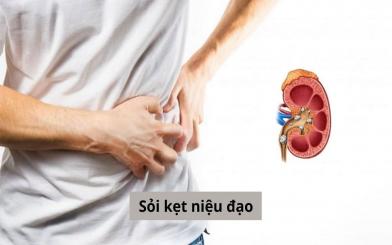 Sỏi kẹt niệu đạo và những điều mọi người cần biết!