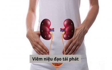 [Giải đáp nhanh] Viêm niệu đạo tái phát do đâu? Có chữa khỏi không?