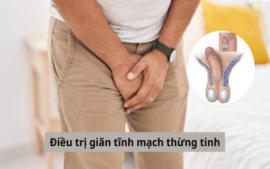 Một số vấn đề cần biết về điều trị giãn tĩnh mạch thừng tinh ở nam giới