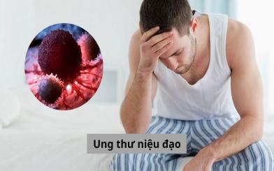 Ung thư niệu đạo: Nguyên nhân, dấu hiệu, yếu tố nguy cơ 