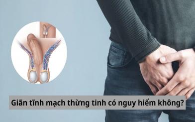 Giãn tĩnh mạch thừng tinh có nguy hiểm không? [Chuyên gia giải đáp]