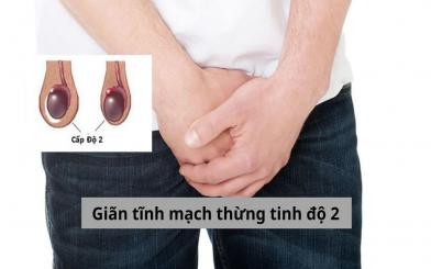 Đừng để giãn tĩnh mạch thừng tinh độ 2 làm phiền bạn