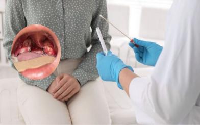 [Góc giải đáp] Bệnh lậu có lây qua đường miệng không? Phòng tránh bệnh lậu bằng cách nào?