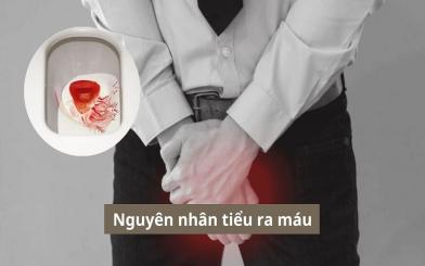 [TỔNG HỢP & GIẢI ĐÁP] Nguyên nhân tiểu ra máu là bị bệnh gì? 