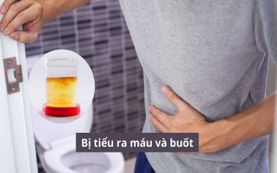 Bị tiểu ra máu và buốt: Cảnh báo với những nguyên do đằng sau
