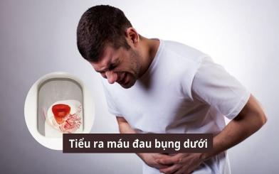 Người bị tiểu ra máu đau bụng dưới có phải mắc bệnh nguy hiểm không? 