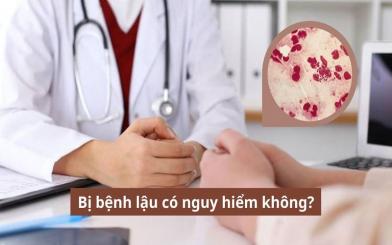 [Góc giải đáp] Bị bệnh lậu có nguy hiểm không và những sai lầm người bệnh thường gặp
