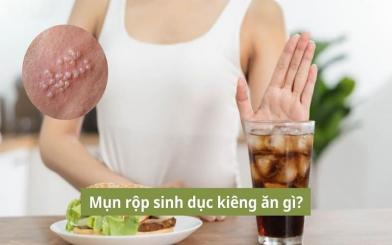 Bị mụn rộp sinh dục kiêng ăn gì thì tốt? Chuyên gia chỉ rõ 5 nhóm thực phẩm nên tránh xa