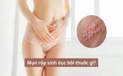 Mụn rộp sinh dục bôi thuốc gì hiệu quả tốt nhất?