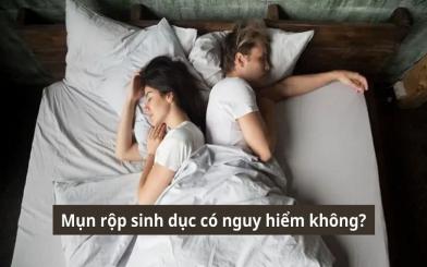 Bệnh mụn rộp sinh dục có nguy hiểm không? [Bác sĩ giải thích]