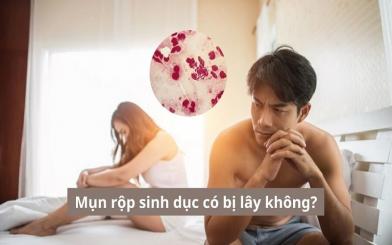 Mụn rộp sinh dục có bị lây không? [Bác sĩ chuyên khoa giải đáp]