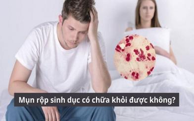 Lắng nghe chuyên gia giải đáp: Mụn rộp sinh dục có chữa khỏi được không?