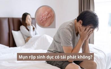 Mụn rộp sinh dục có tái phát không: Nguyên nhân, tần suất và cách phòng tránh hiệu quả