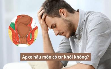 Áp xe hậu môn có tự khỏi không? - Giải đáp từ chuyên gia