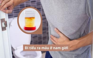 Đi tiểu ra máu ở nam giới: Nguyên nhân và phương pháp điều trị hiệu quả