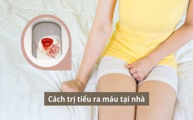 Cách trị tiểu ra máu tại nhà hiện nay có thực sự hiệu quả không?