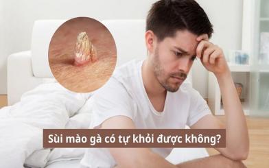 Sùi mào gà có tự khỏi được không hay cần điều trị chuyên khoa?