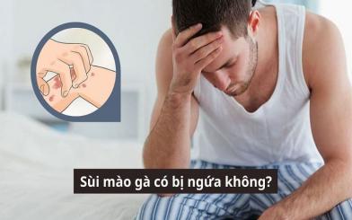 Sùi mào gà có bị ngứa không? 5 dấu hiệu cơ bản cần lưu ý