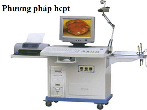 Phương pháp HCPT điều trị polyp hậu môn hiệu quả
